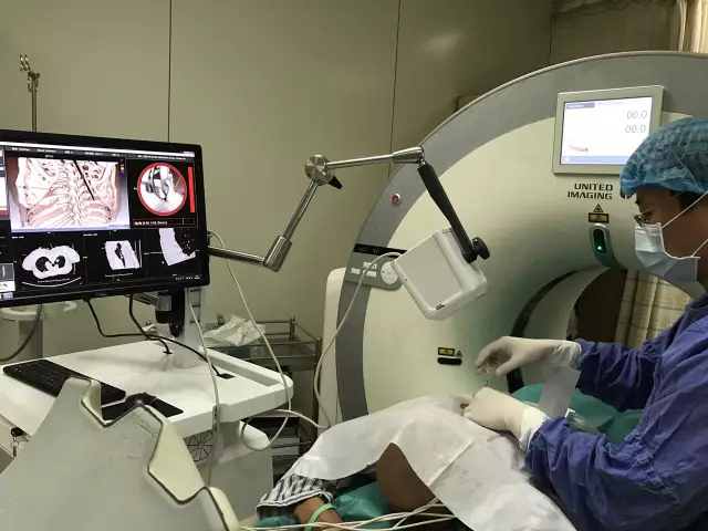 IQQA-Guide三维影像术中导航系统获创新医械特别审批，推动精准医疗新发展