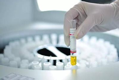 中国IVD试剂临床使用现状与挑战 基于诊断技术研发视角的分析